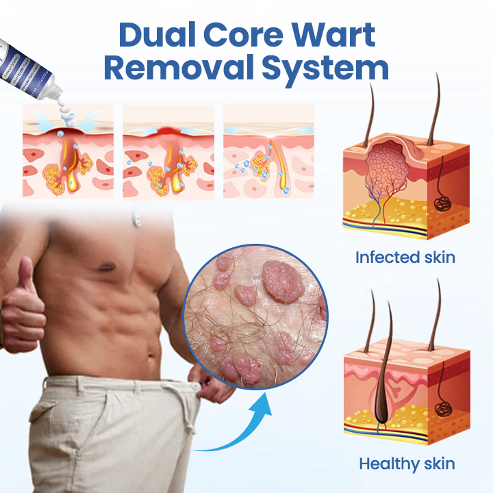 LOVILDS™  WartRelief Cream