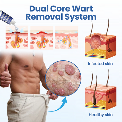 LOVILDS™  WartRelief Cream