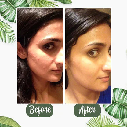 Final Sale - Green Tea Deep Cleanse Mask （🔥LAST DAY SALE-80% OFF)