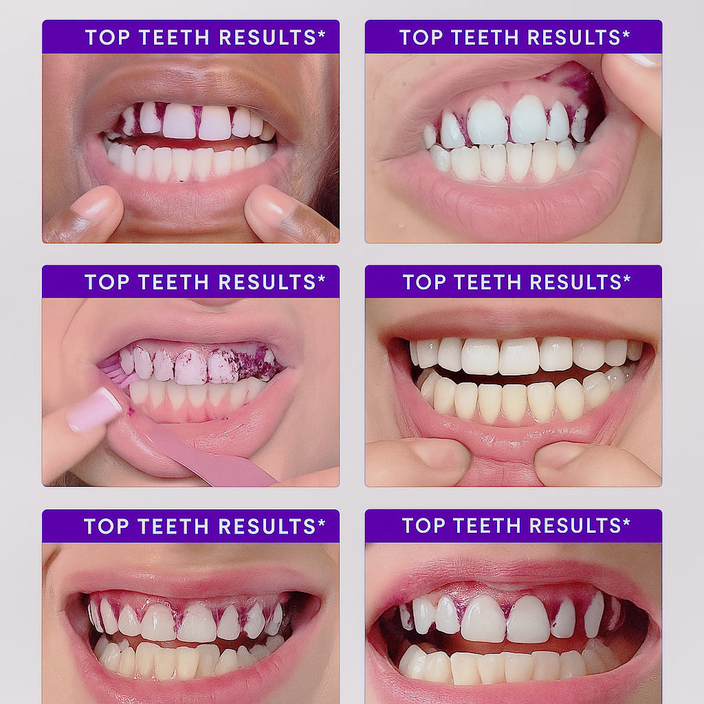 🔥Last day 50% off —— Histone Whitening Strips